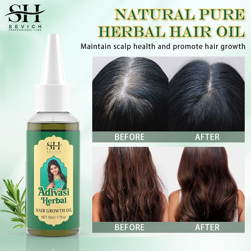 Ayurvedic Hair Growth Oil Adiv - Coconut Oil Refined recensie en prijs